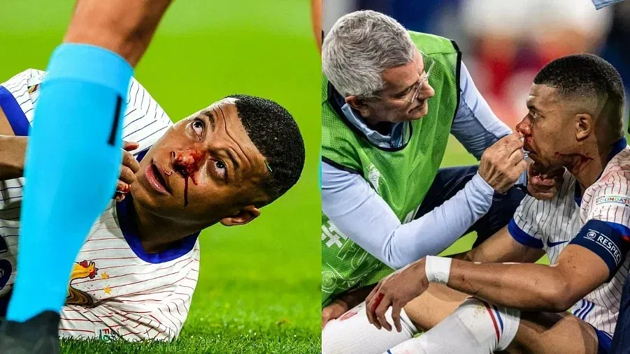 Kylian Mbappe Injury